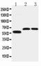 Solute Carrier Family 1 Member 4 antibody, LS-C313288, Lifespan Biosciences, Western Blot image 