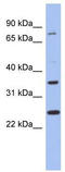 Zinc Finger Protein 133 antibody, TA343396, Origene, Western Blot image 