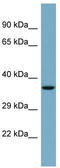 Glycosyltransferase Like Domain Containing 1 antibody, TA346827, Origene, Western Blot image 