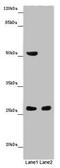 Friend of PRMT1 protein antibody, LS-C677544, Lifespan Biosciences, Western Blot image 