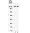 Neurotrophic Receptor Tyrosine Kinase 2 antibody, R32247, NSJ Bioreagents, Western Blot image 