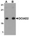 OCIA Domain Containing 2 antibody, A13969, Boster Biological Technology, Western Blot image 