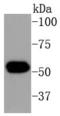 Keratin 16 antibody, A03393-1, Boster Biological Technology, Western Blot image 