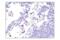 AXL Receptor Tyrosine Kinase antibody, 8661S, Cell Signaling Technology, Immunohistochemistry paraffin image 