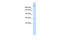 ATPase Phospholipid Transporting 10D (Putative) antibody, 26-413, ProSci, Western Blot image 