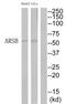 Arylsulfatase B antibody, TA311720, Origene, Western Blot image 