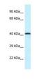 Purinergic Receptor P2X 2 antibody, NBP1-82393, Novus Biologicals, Western Blot image 