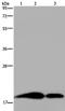 Regenerating Family Member 3 Gamma antibody, PA5-50450, Invitrogen Antibodies, Western Blot image 