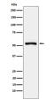 Tryptophanyl-TRNA Synthetase antibody, M02444, Boster Biological Technology, Western Blot image 