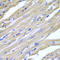 Heat Shock Protein Family B (Small) Member 2 antibody, LS-C346058, Lifespan Biosciences, Immunohistochemistry paraffin image 