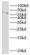 Mahogunin Ring Finger 1 antibody, FNab07342, FineTest, Western Blot image 