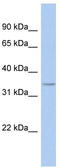 Fat Storage Inducing Transmembrane Protein 1 antibody, TA337626, Origene, Western Blot image 