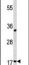 Destrin, Actin Depolymerizing Factor antibody, PA5-26197, Invitrogen Antibodies, Western Blot image 