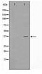 Cyclin Dependent Kinase Like 4 antibody, TA347732, Origene, Western Blot image 