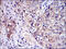 Interleukin 1 Receptor Associated Kinase 4 antibody, M01247-1, Boster Biological Technology, Immunohistochemistry paraffin image 