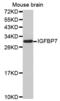 Insulin Like Growth Factor Binding Protein 7 antibody, PA5-76685, Invitrogen Antibodies, Western Blot image 