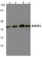 Aldose reductase antibody, A01621, Boster Biological Technology, Western Blot image 