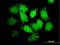 Phosphatidylinositol Specific Phospholipase C X Domain Containing 1 antibody, H00055344-B01P, Novus Biologicals, Immunocytochemistry image 