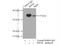 Protein Phosphatase 4 Catalytic Subunit antibody, 10262-1-AP, Proteintech Group, Immunoprecipitation image 