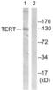 Telomerase Reverse Transcriptase antibody, LS-C118019, Lifespan Biosciences, Western Blot image 