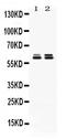 Chaperonin Containing TCP1 Subunit 5 antibody, PB9928, Boster Biological Technology, Western Blot image 