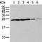 Zinc Finger Matrin-Type 2 antibody, PA5-67539, Invitrogen Antibodies, Western Blot image 