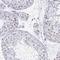 CCCTC-Binding Factor antibody, NBP2-52909, Novus Biologicals, Immunohistochemistry paraffin image 
