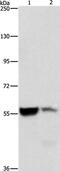 Aldehyde Dehydrogenase 8 Family Member A1 antibody, PA5-50315, Invitrogen Antibodies, Western Blot image 