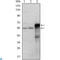 ETS Proto-Oncogene 1, Transcription Factor antibody, LS-C812594, Lifespan Biosciences, Immunohistochemistry paraffin image 