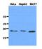 Dynein Axonemal Light Chain 1 antibody, GTX53709, GeneTex, Western Blot image 