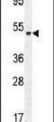 Serpin Family I Member 1 antibody, PA5-23892, Invitrogen Antibodies, Western Blot image 