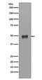 Keratin 17 antibody, M02289-1, Boster Biological Technology, Western Blot image 