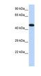 A-kinase anchor protein 5 antibody, NBP1-54807, Novus Biologicals, Western Blot image 