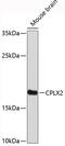 Complexin 2 antibody, 19-379, ProSci, Western Blot image 