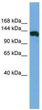 HAUS Augmin Like Complex Subunit 6 antibody, TA344983, Origene, Western Blot image 