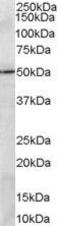 PR/SET Domain 11 antibody, GTX89551, GeneTex, Western Blot image 