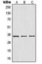 NFKB Inhibitor Alpha antibody, MBS821495, MyBioSource, Western Blot image 