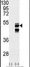 Protein Phosphatase, Mg2+/Mn2+ Dependent 1F antibody, PA5-15571, Invitrogen Antibodies, Western Blot image 