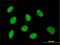 Zinc Finger Protein 143 antibody, H00007702-M02, Novus Biologicals, Immunofluorescence image 