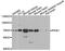 Serine/threonine-protein kinase PINK1, mitochondrial antibody, A11435, ABclonal Technology, Western Blot image 