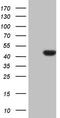 Cyclin Dependent Kinase Like 1 antibody, LS-C790708, Lifespan Biosciences, Western Blot image 