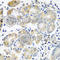 Plastin 3 antibody, A3627, ABclonal Technology, Immunohistochemistry paraffin image 