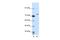 Exosome Component 10 antibody, A02746, Boster Biological Technology, Western Blot image 