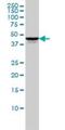 Testis Specific Serine Kinase 2 antibody, H00023617-M01, Novus Biologicals, Western Blot image 