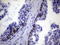 Inhibitor Of Nuclear Factor Kappa B Kinase Subunit Epsilon antibody, LS-C794087, Lifespan Biosciences, Immunohistochemistry paraffin image 