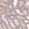Transmembrane Protein 151B antibody, NBP2-30694, Novus Biologicals, Immunohistochemistry frozen image 