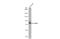 Early Growth Response 1 antibody, GTX129015, GeneTex, Western Blot image 