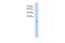 Solute Carrier Family 25 Member 45 antibody, A14907, Boster Biological Technology, Western Blot image 