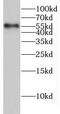 Glycine Receptor Beta antibody, FNab03489, FineTest, Western Blot image 