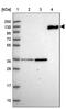 Complement C6 antibody, PA5-60527, Invitrogen Antibodies, Western Blot image 